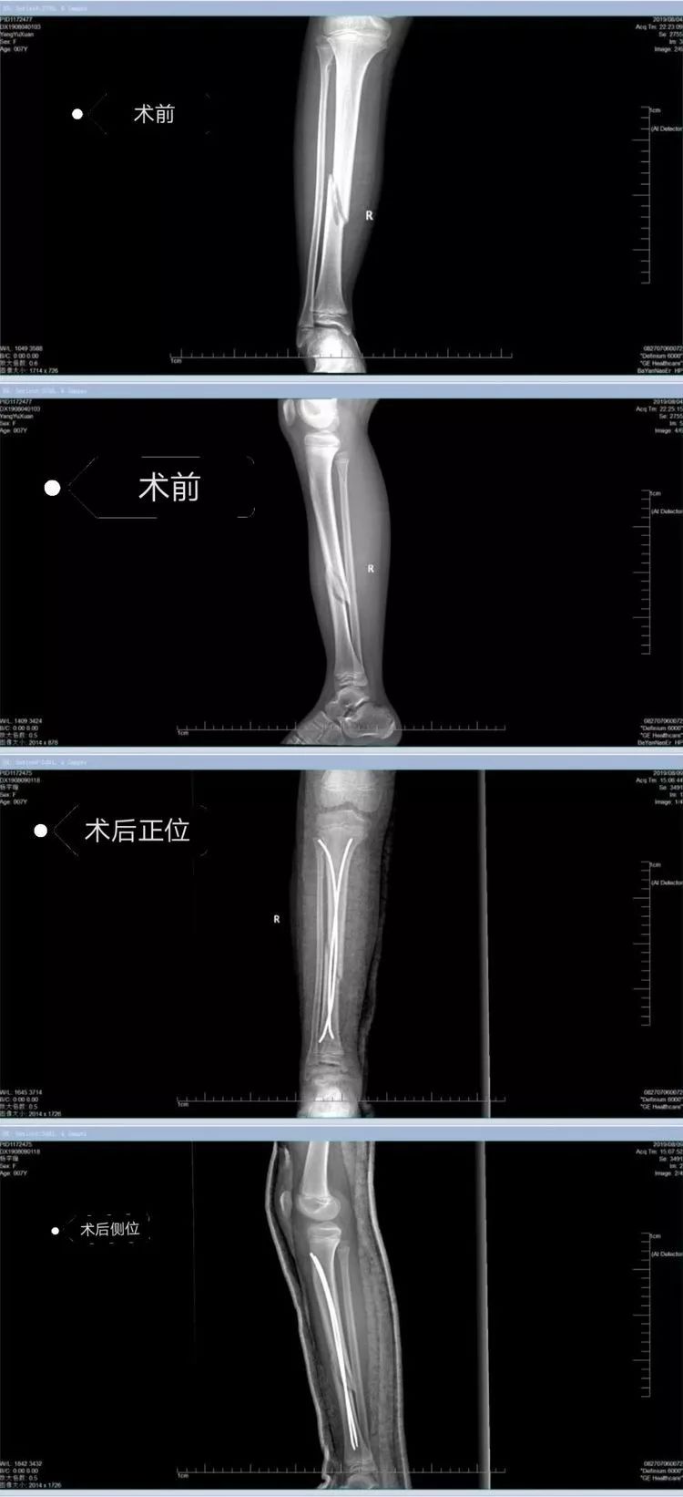 哆啦A梦：伴我同行2 推荐视频
